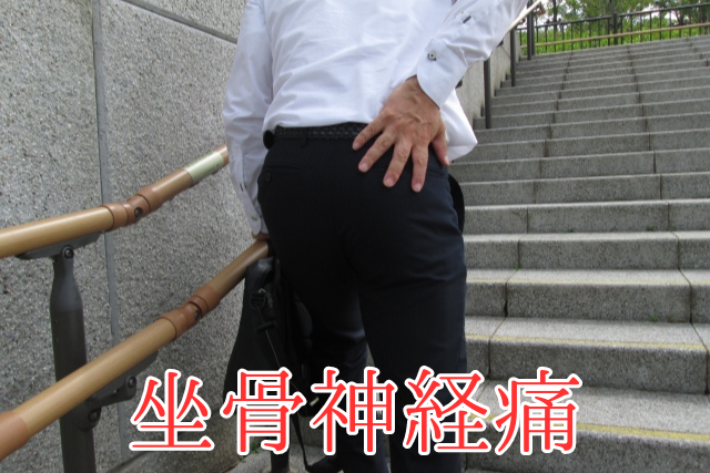 坐骨神経痛